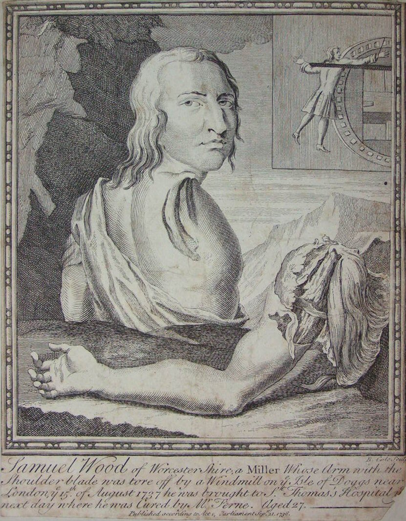 Print - Samuel Wood of Worcestershire, a Miller, whose arm with the shoulder blade was tore off by a Windmill on the Isle of Doggs  - Cole